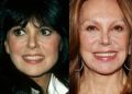 marlo thomas's makeover with plastic surgery: before and after
